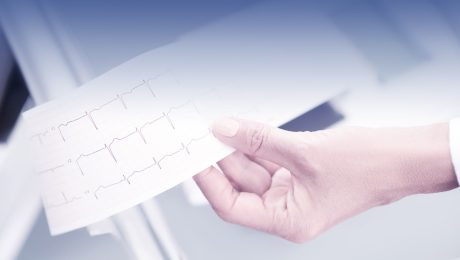 electrocardiograma-en-santiago